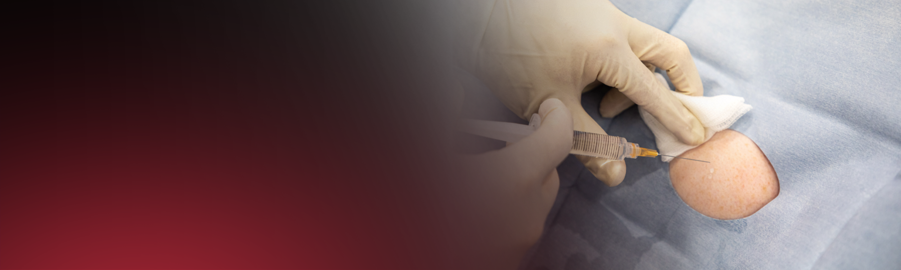 Joint Injections | South East Radiology